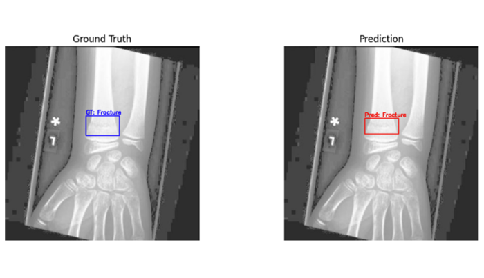 I Will Develop a Deep Learning Model for Object Detection and Classification